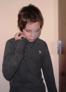 You can see where we've cut the hair along the top of his head to keep it away from his eye shield.   What he needs is a buzz cut for the summer.