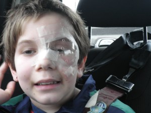 note the ridiculous amount of tape all over his face in our attempt to keep him from touching his eye