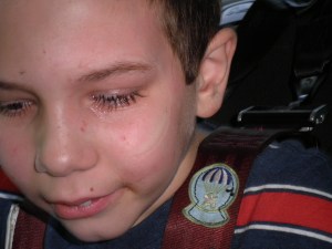 We'd taken the eye shield of to give him his drop but you can see how it looked all gooky