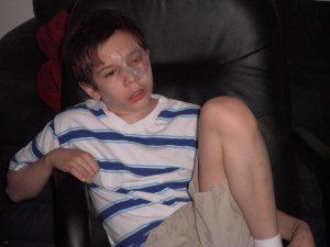 June: The endless wearing of the eye shield